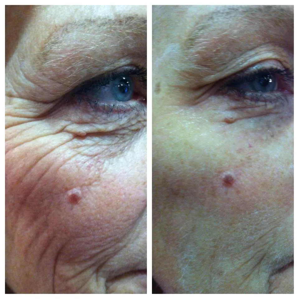 Easy Facelift - Instant Firming & Lifting Serum
