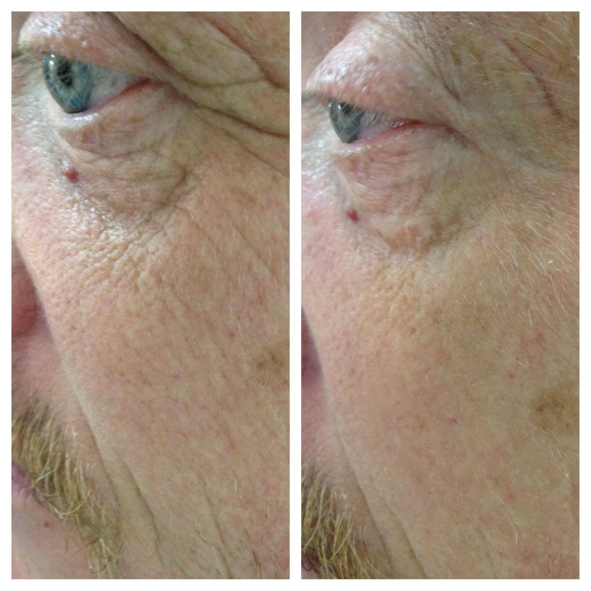 Easy Facelift - Instant Firming & Lifting Serum